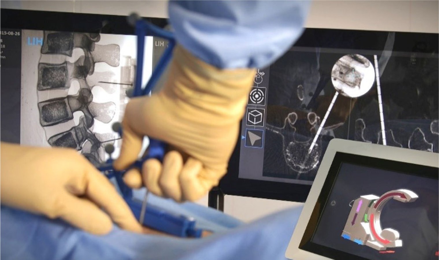 Grenoble-based Ecential Robotics raises € 100m to become a leader in  surgical robotics